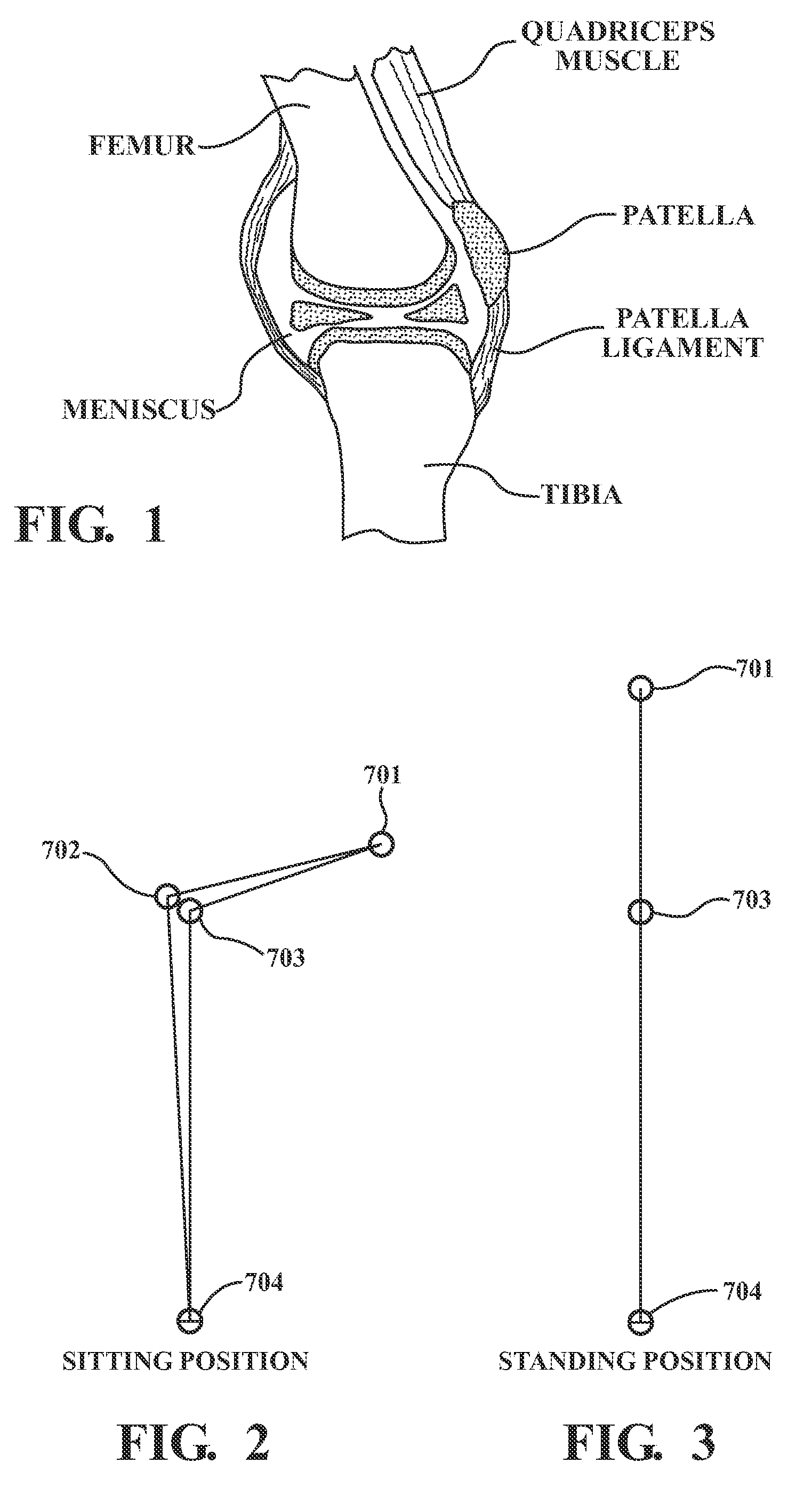 Dynamic load bearing shock absorbing exoskeletal knee brace