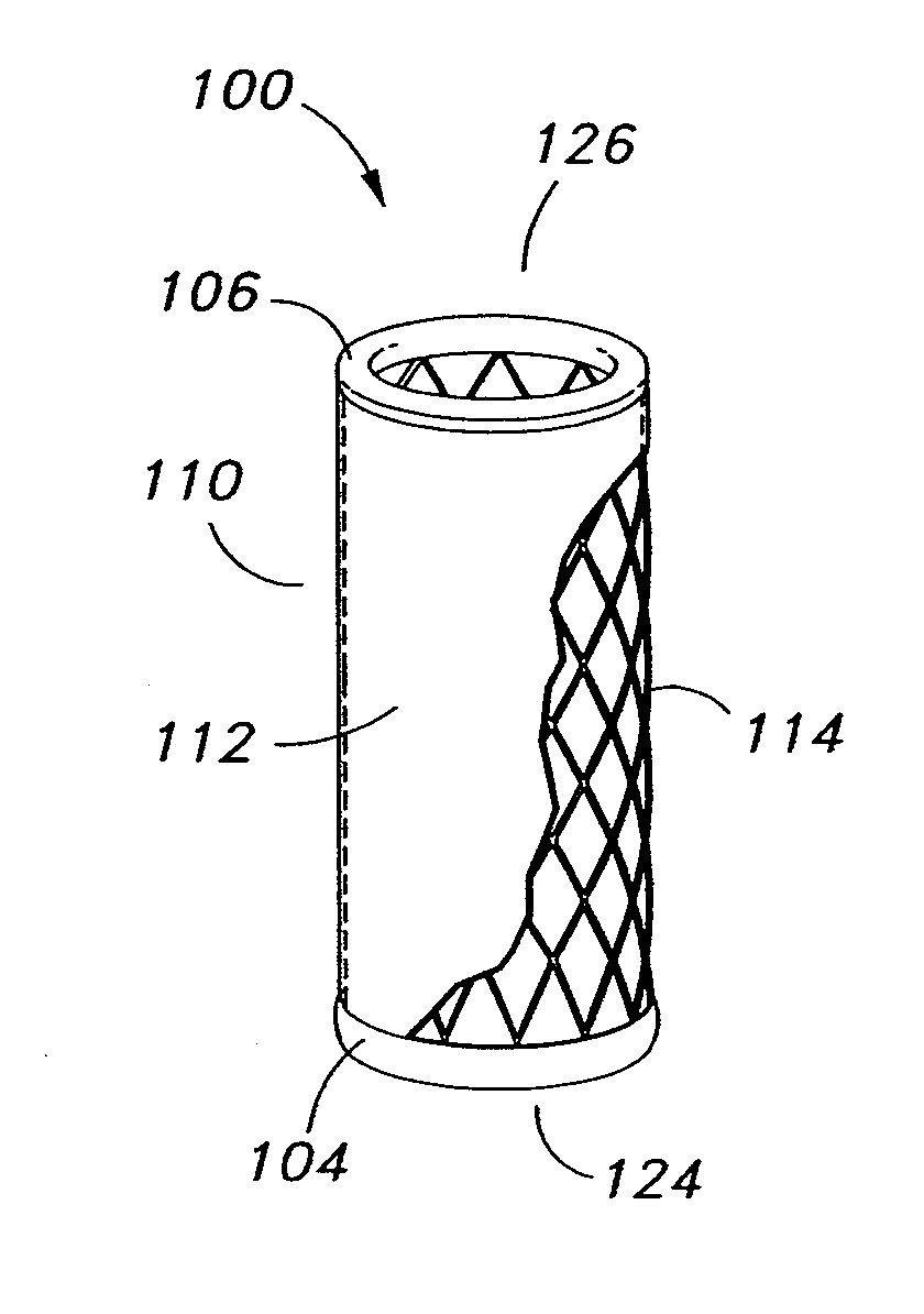 Adjustable prosthetic valve implant