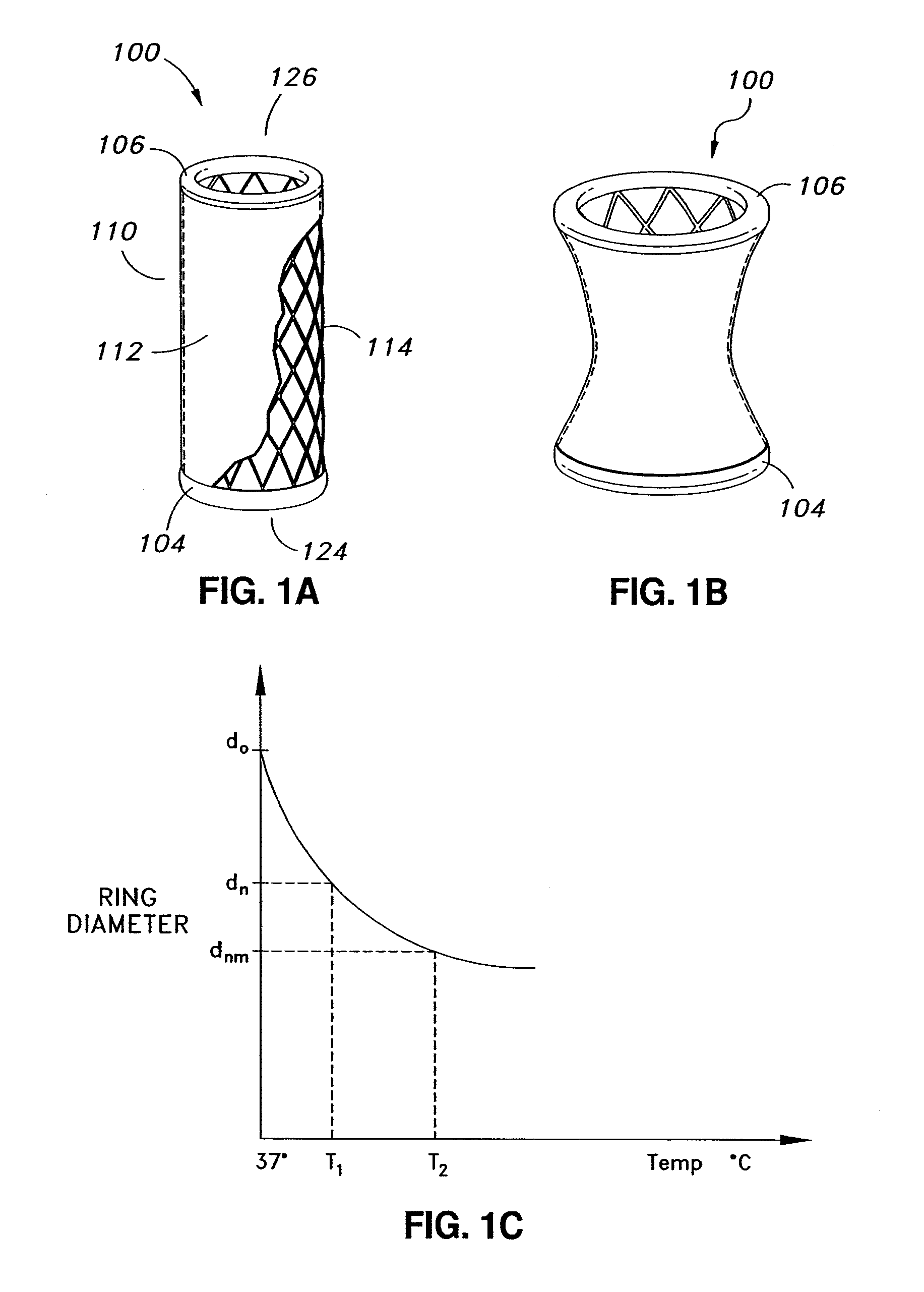 Adjustable prosthetic valve implant