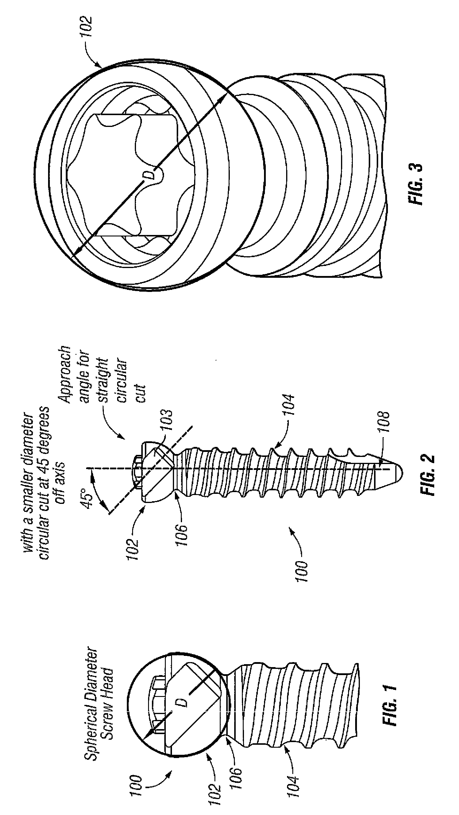 Spinal Stabilization Systems and Methods