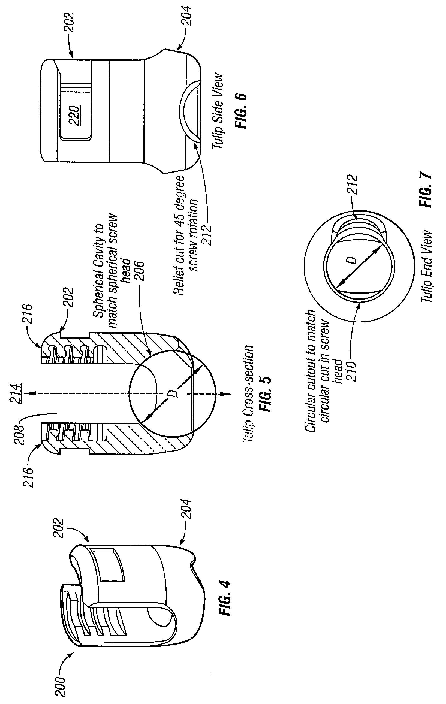 Spinal Stabilization Systems and Methods