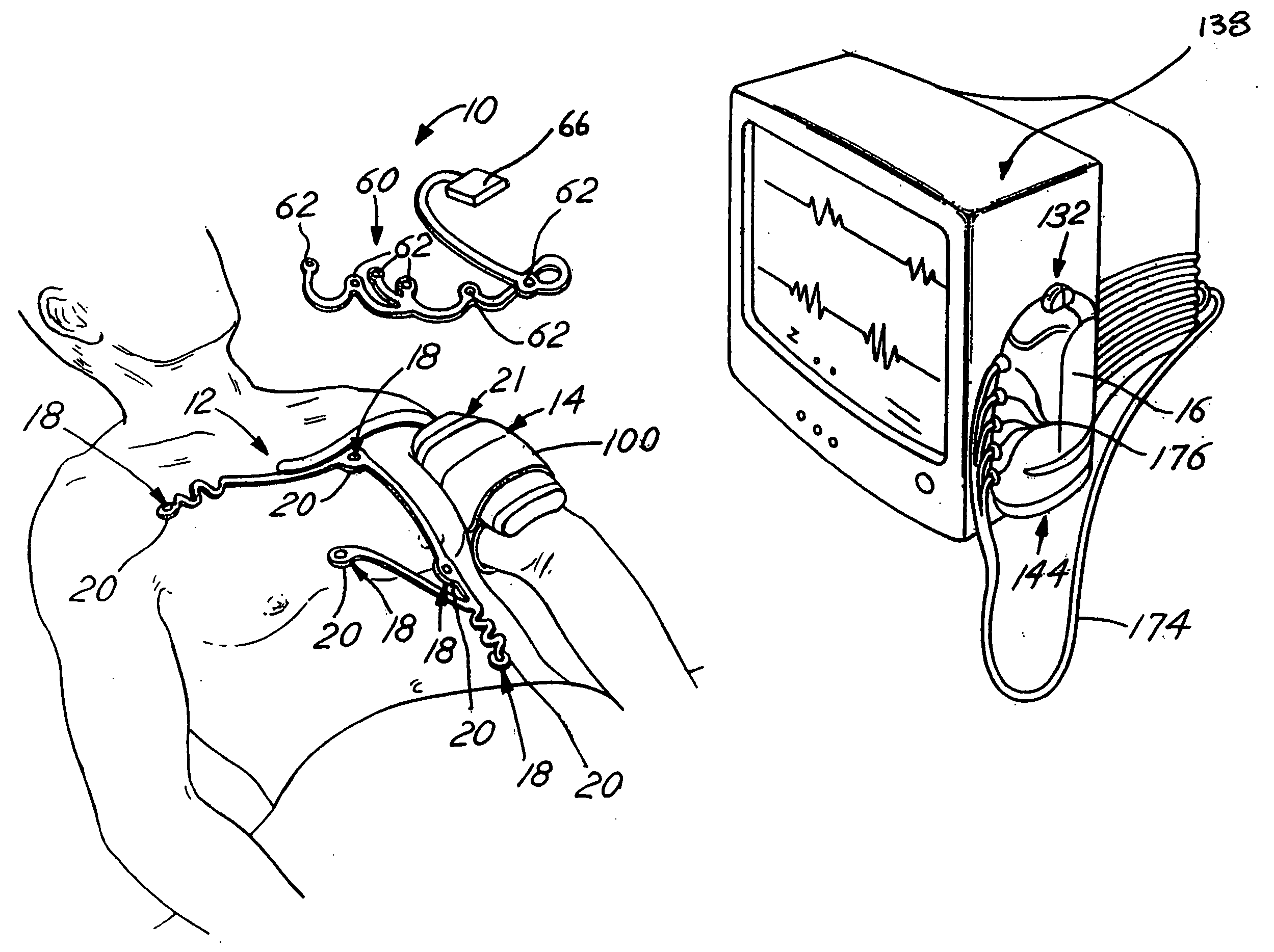 Vital signs monitoring assembly having elastomeric connectors