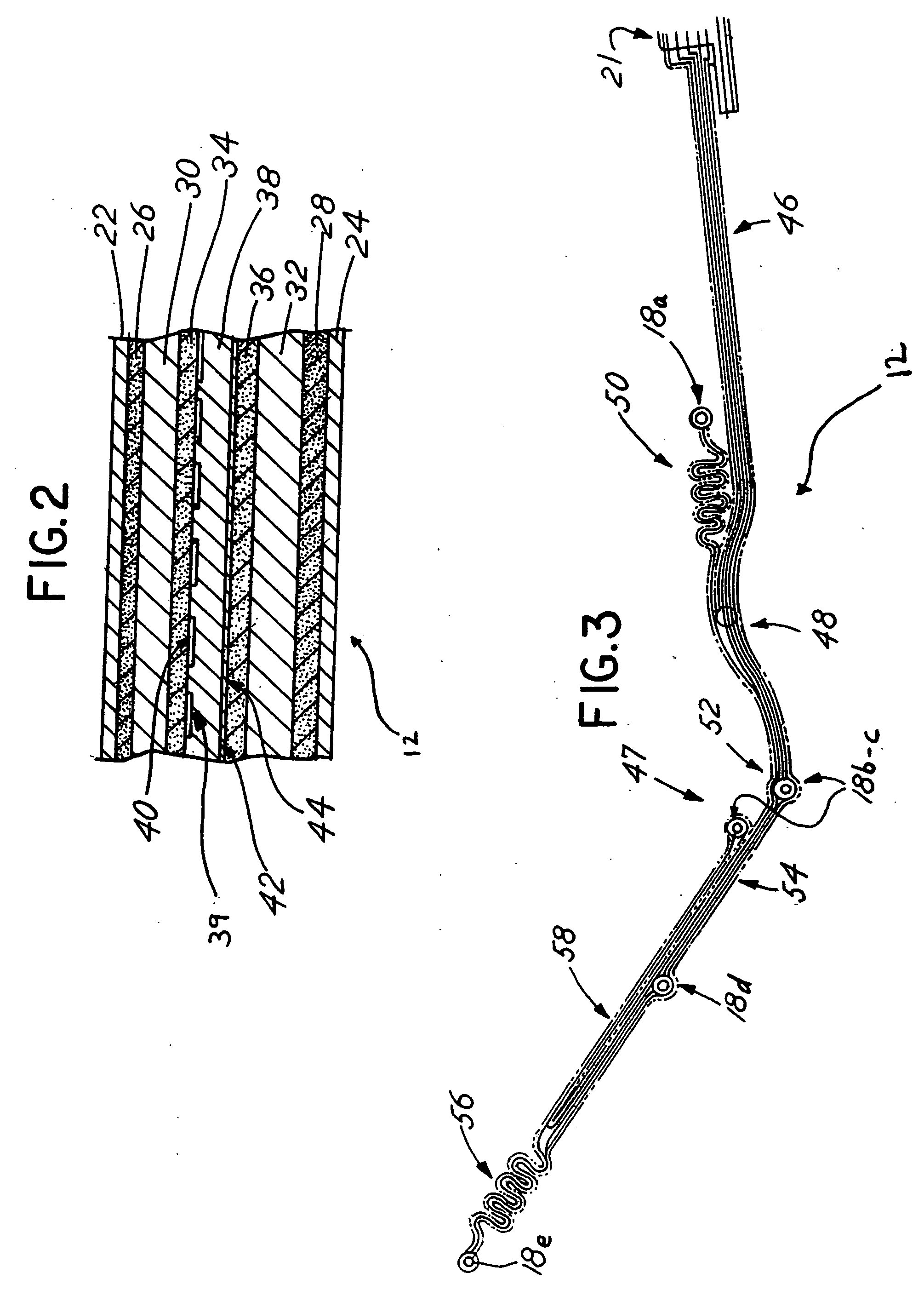 Vital signs monitoring assembly having elastomeric connectors