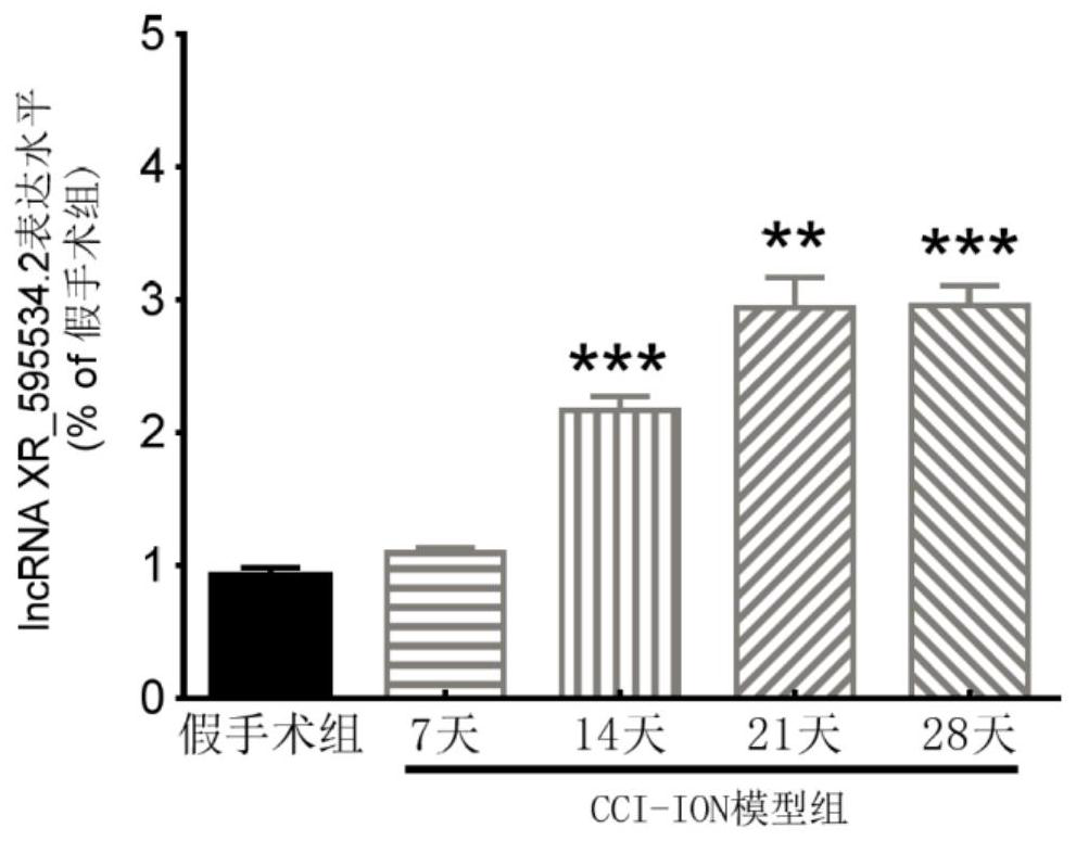 Application of lncrna XR_595534.2 in the preparation of drugs for the treatment or prevention of chronic pain