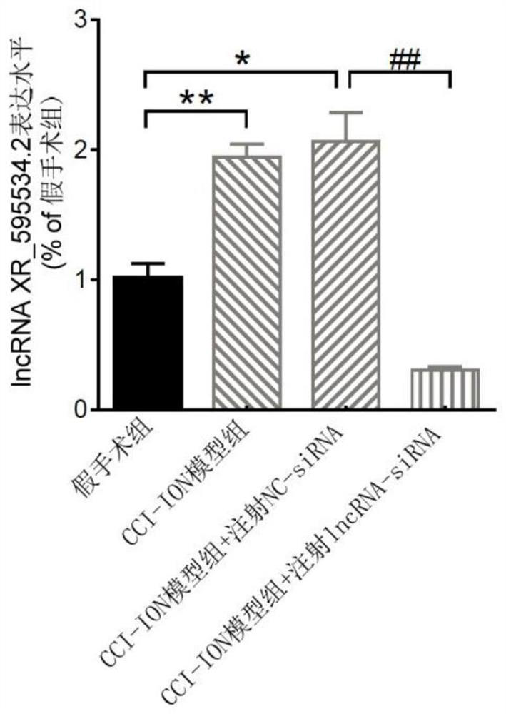 Application of lncrna XR_595534.2 in the preparation of drugs for the treatment or prevention of chronic pain