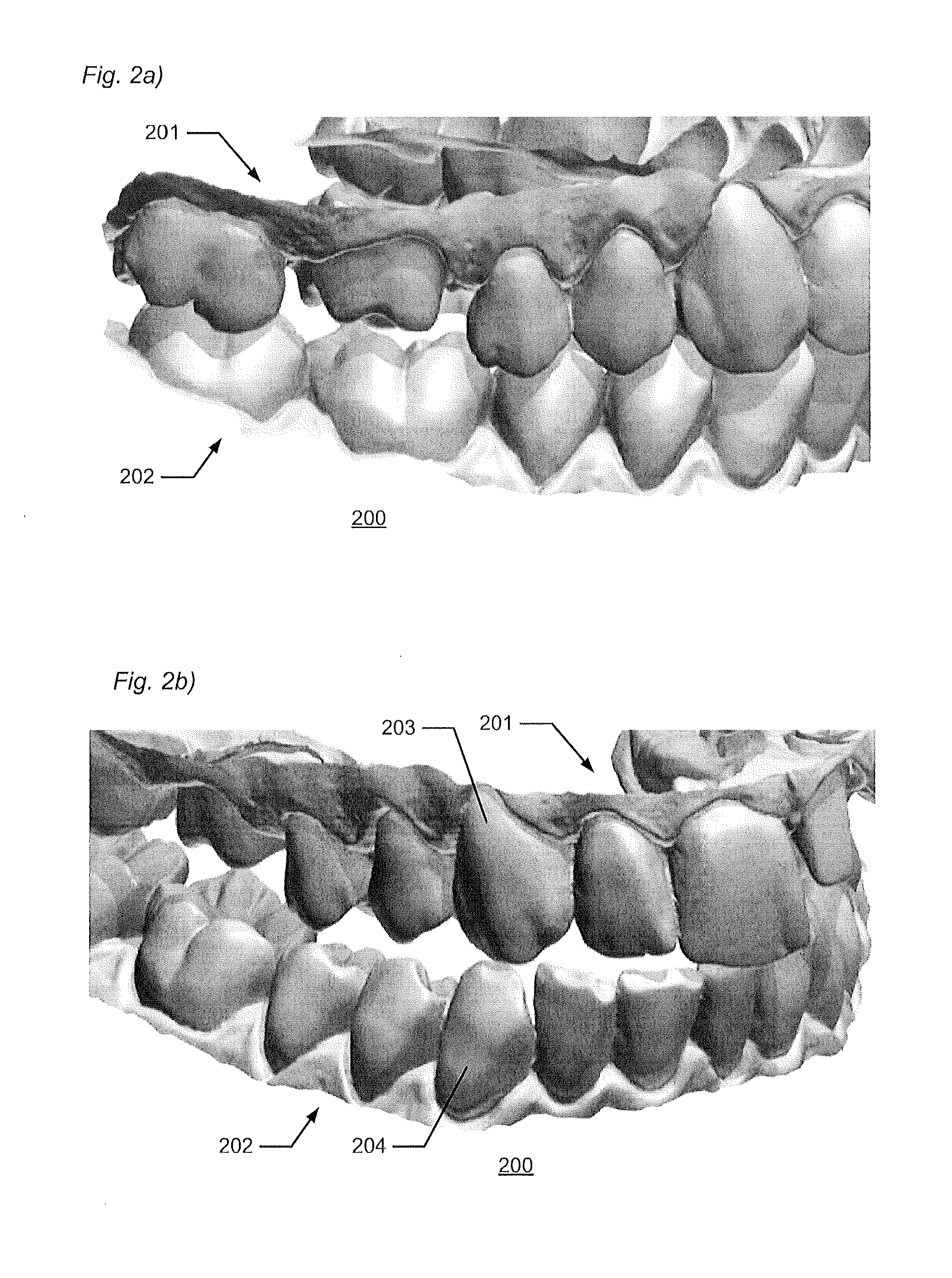 Multiple bite configurations