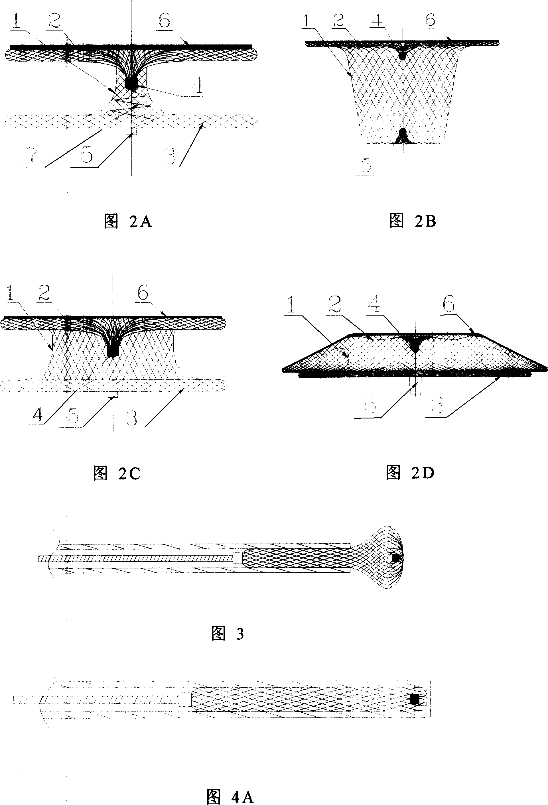 Heart septal defect blocking device