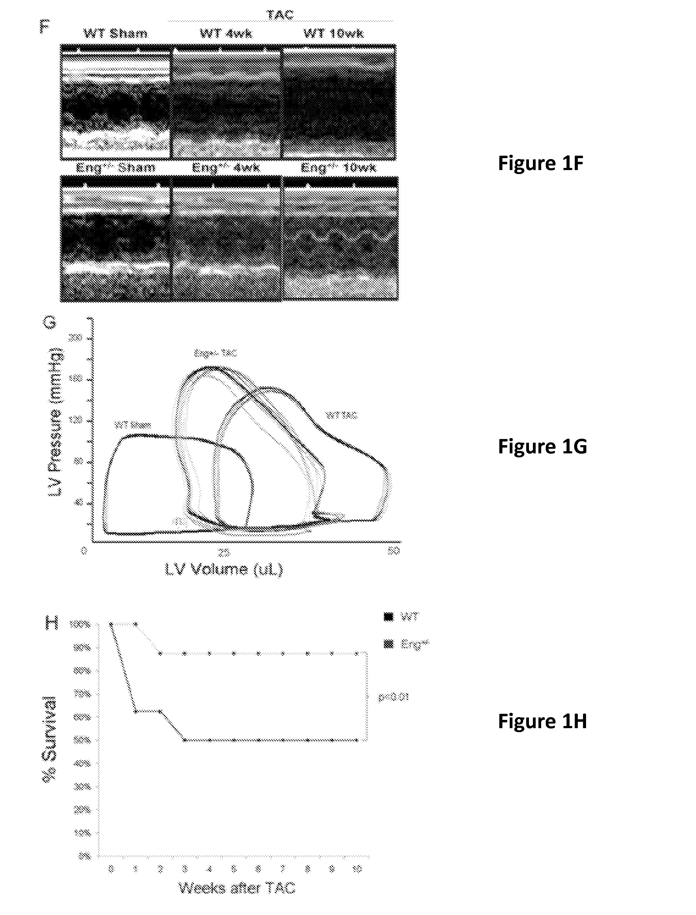 Treatment of heart failure and related conditions