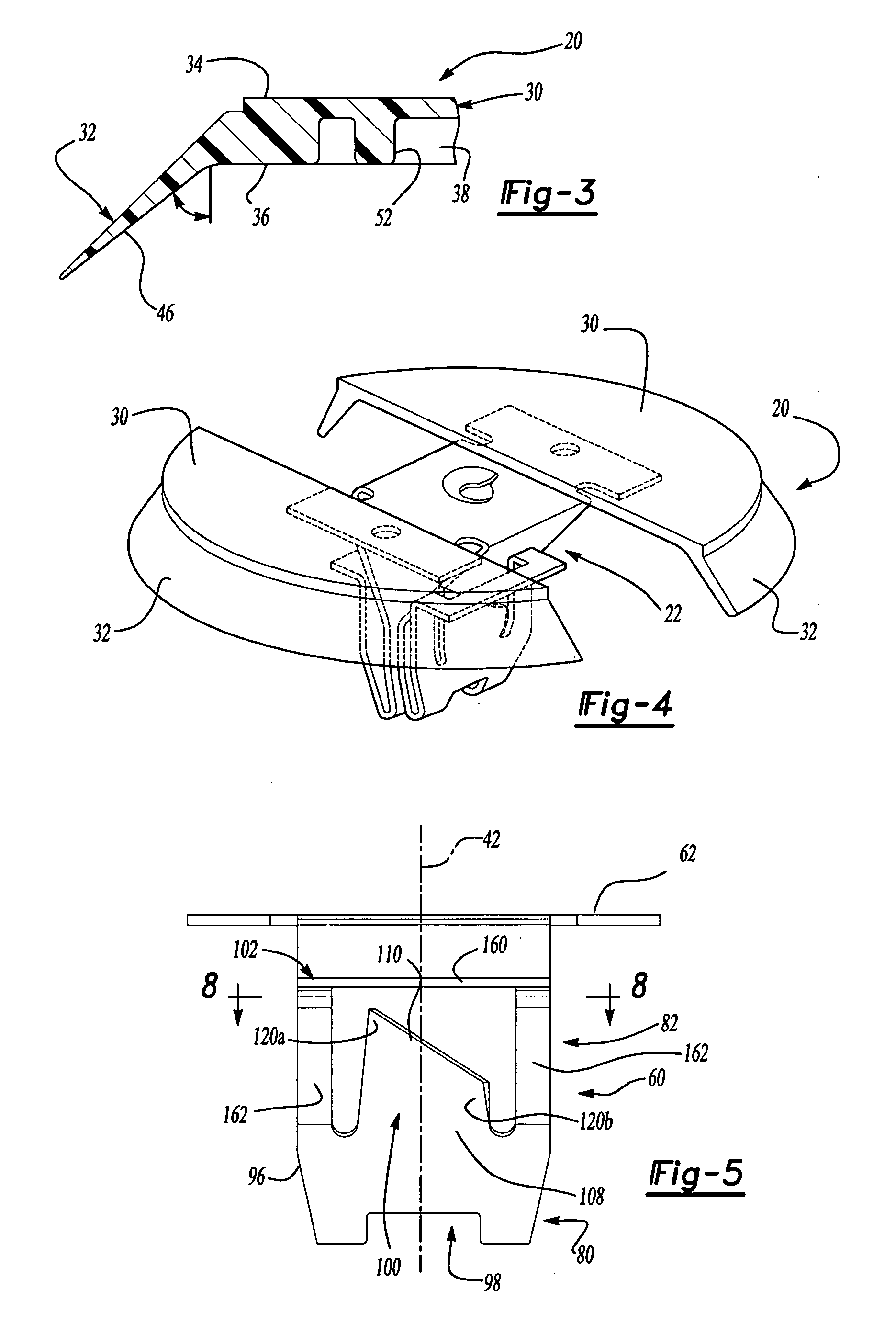 Resilient clip fastener