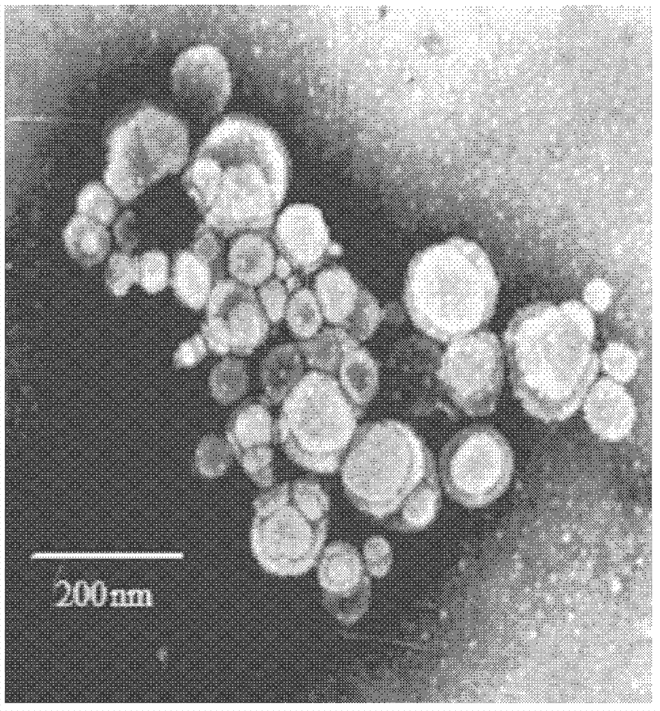 Nimodipine freeze-dried solid lipid nanoparticle and preparation method thereof