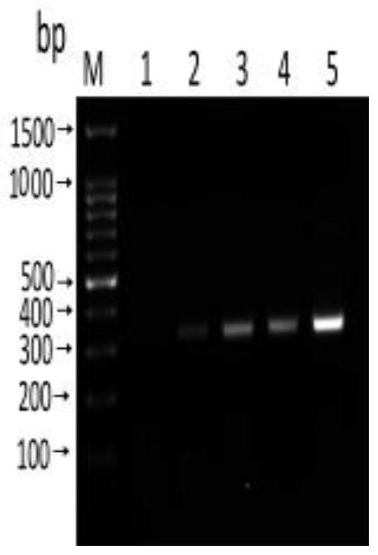 Primer combination, and detection reagent or kit for anisakis