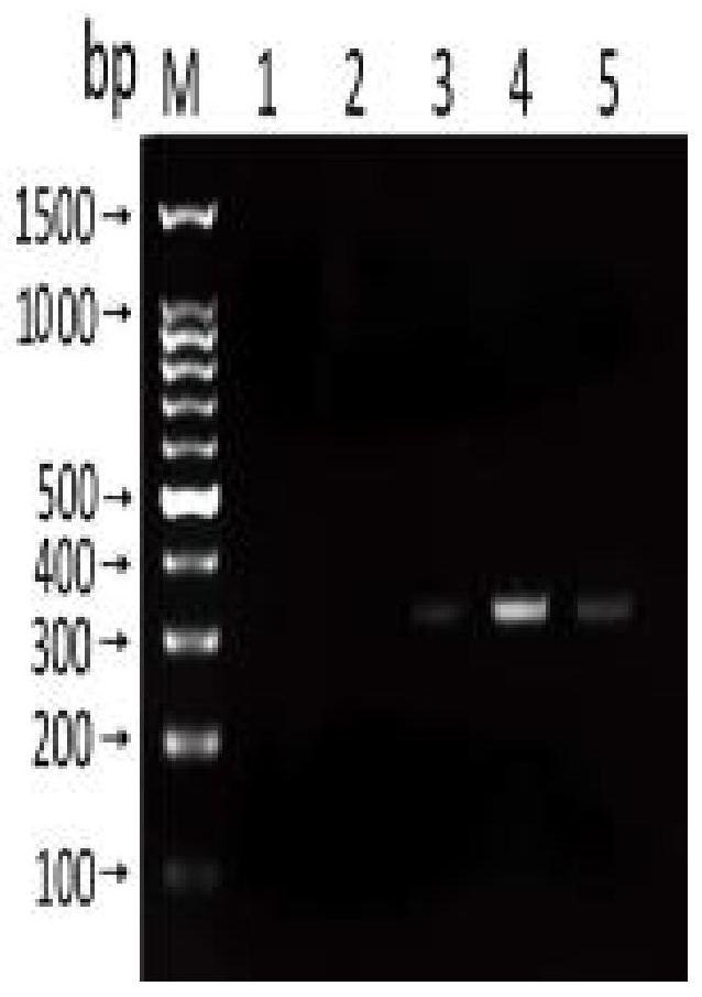 Primer combination, and detection reagent or kit for anisakis