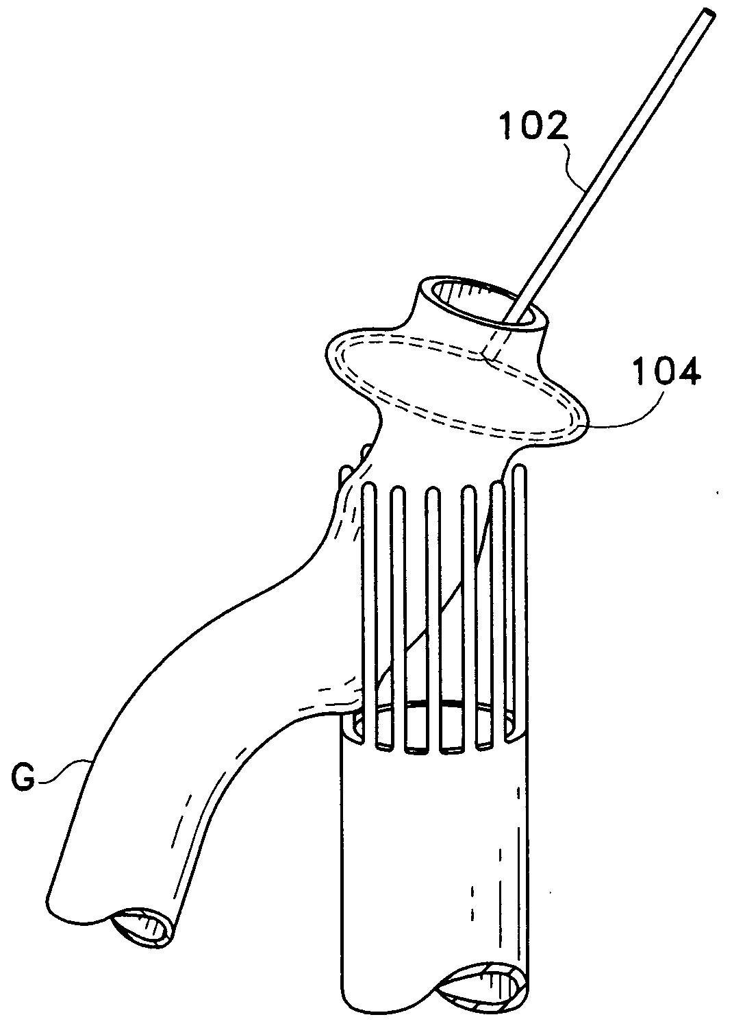 Eversion apparatus and methods