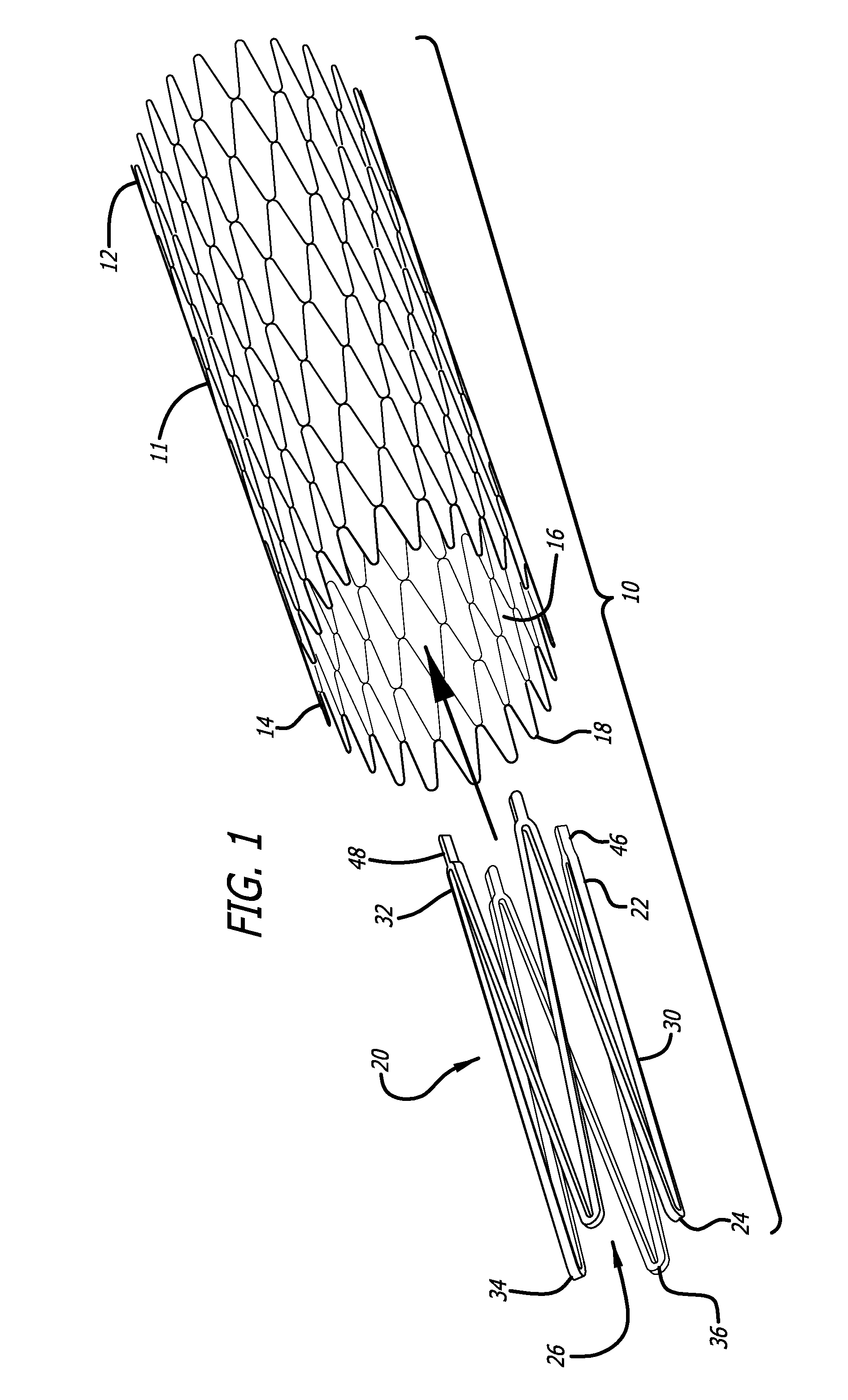 Braided stent with expansion ring and method of delivery