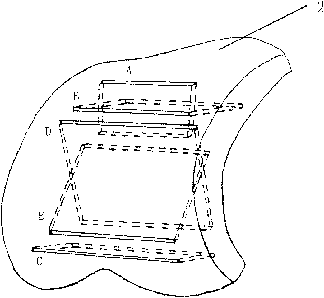 Knee-joint prosthesis implantation process, osteotomy module thereof and device thereof