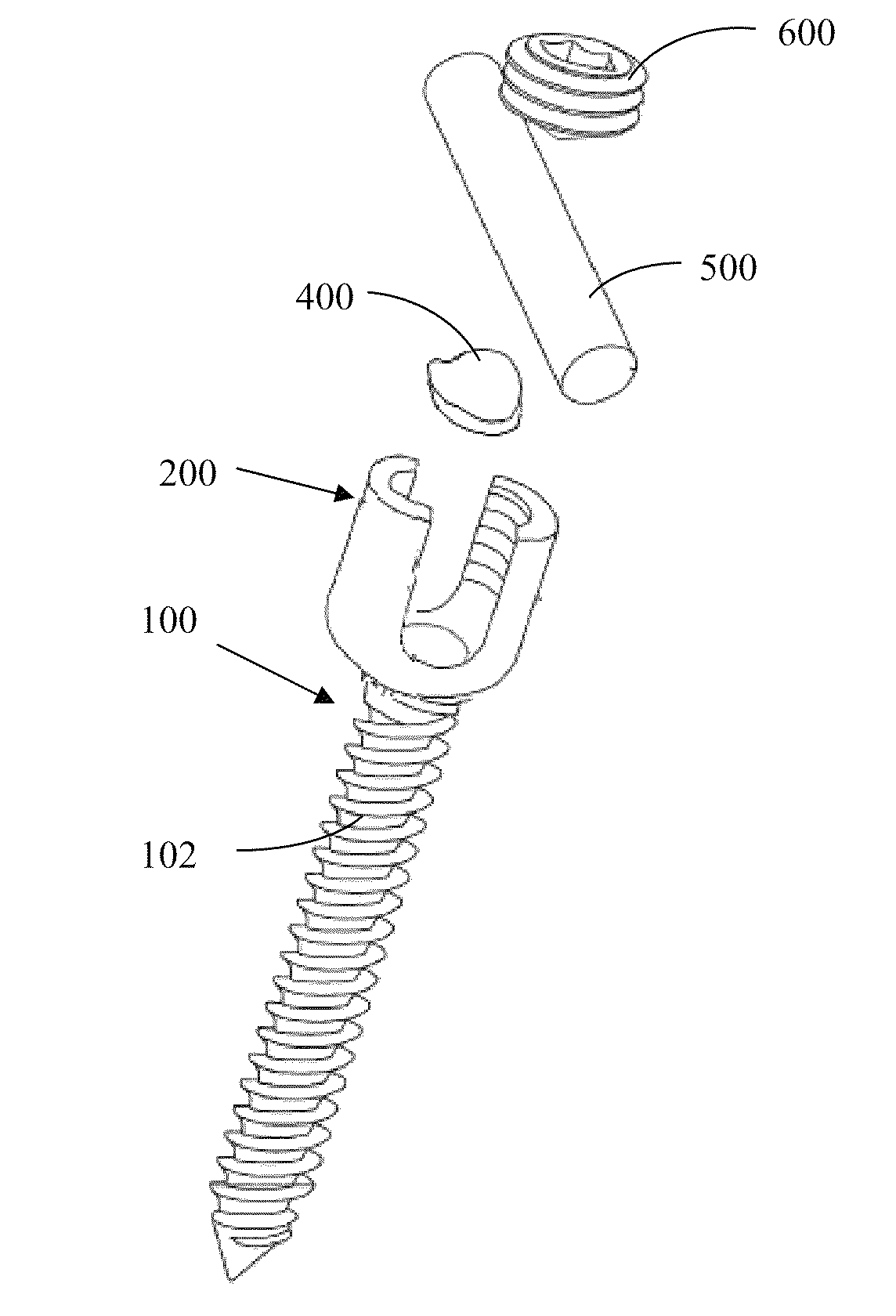 Translational manipulation polyaxial screw head