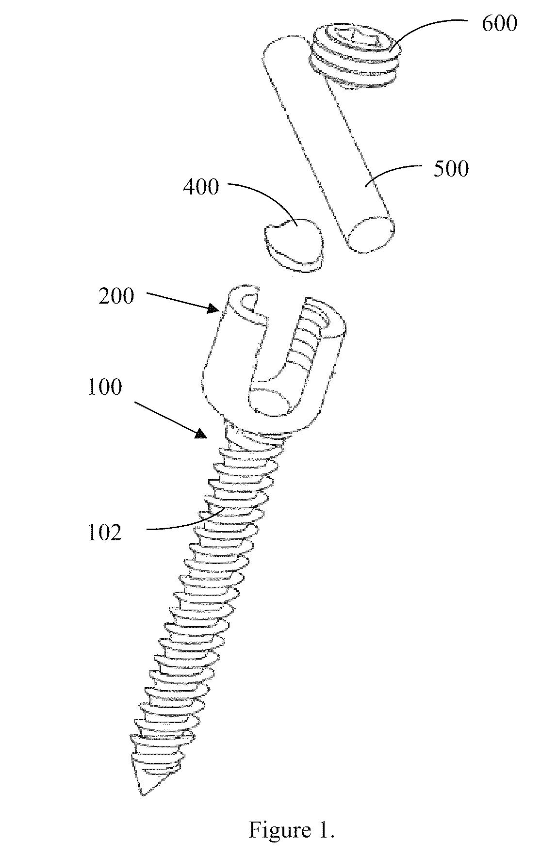 Translational manipulation polyaxial screw head