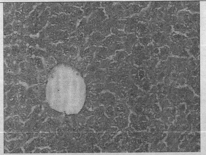 Antitubercular pharmaceutical composition containing balloonflower root extract