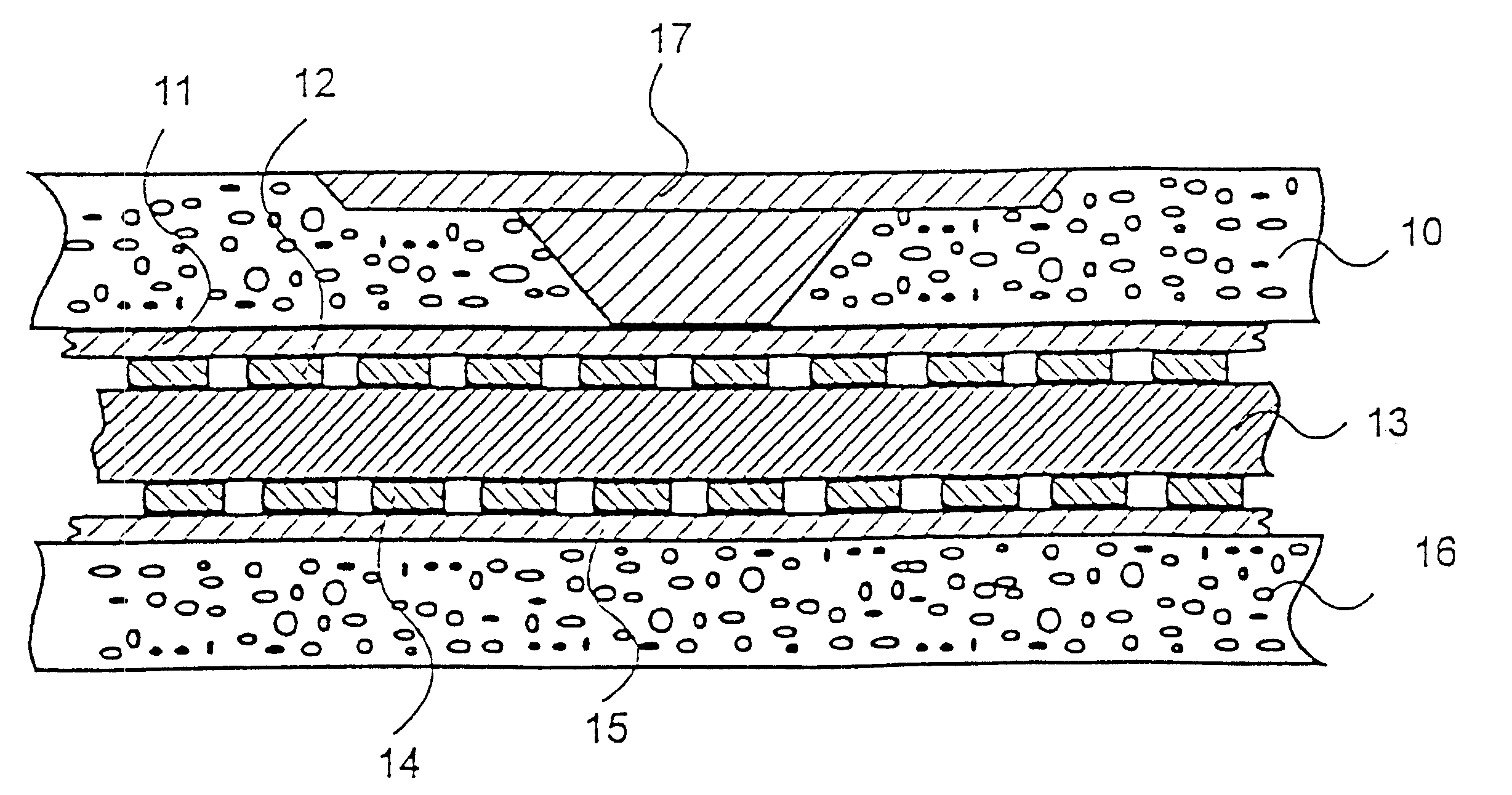 Injection-moulded card with decorative layer