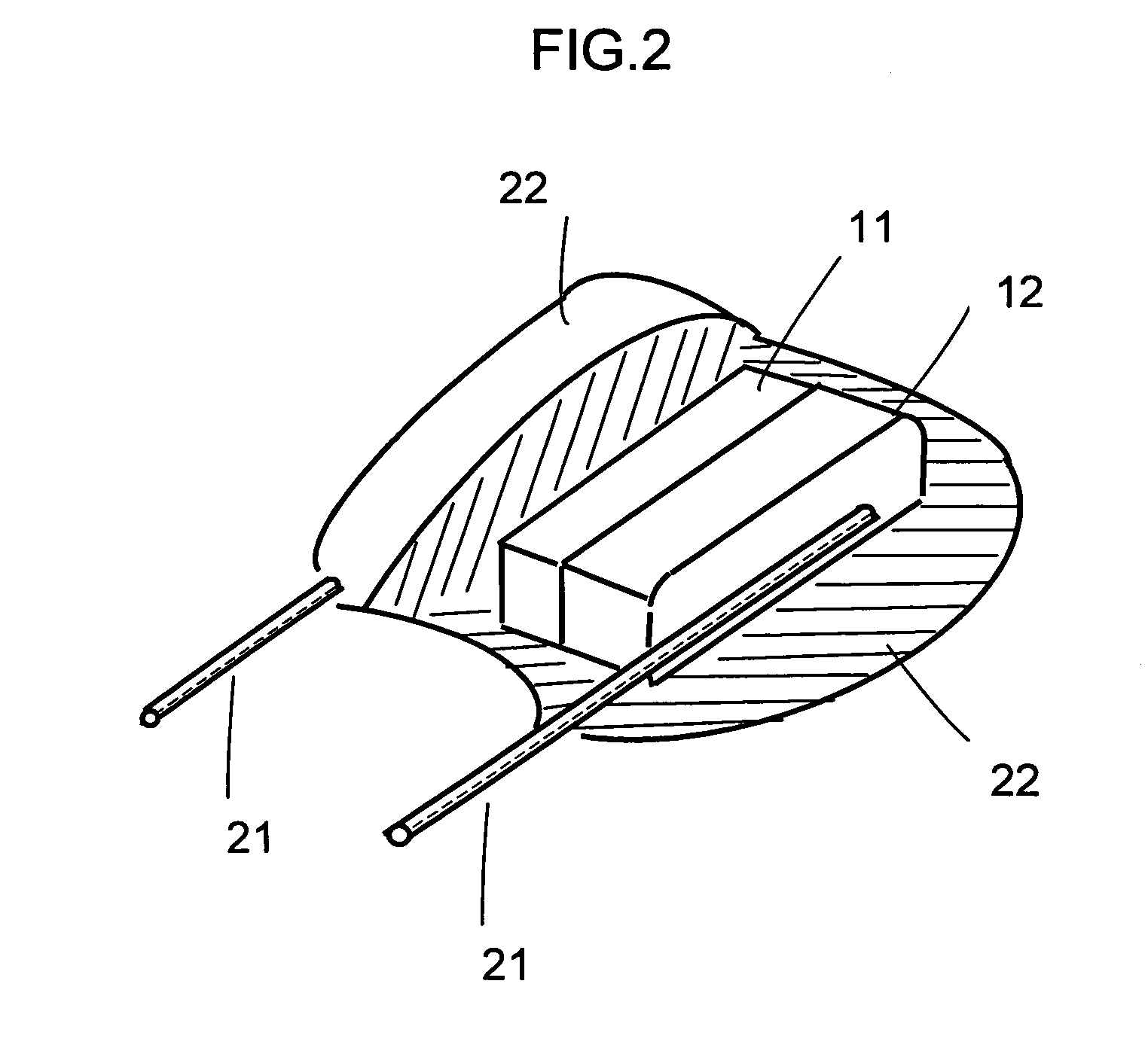 Partial conformal coating of electronic ceramic component and method making the same