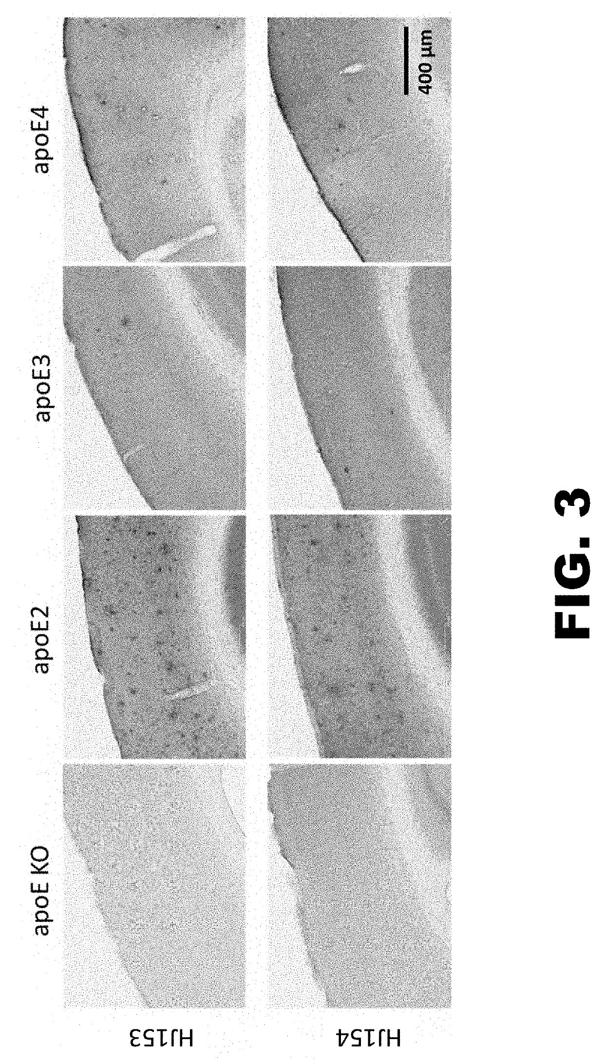 Anti-apoe antibodies