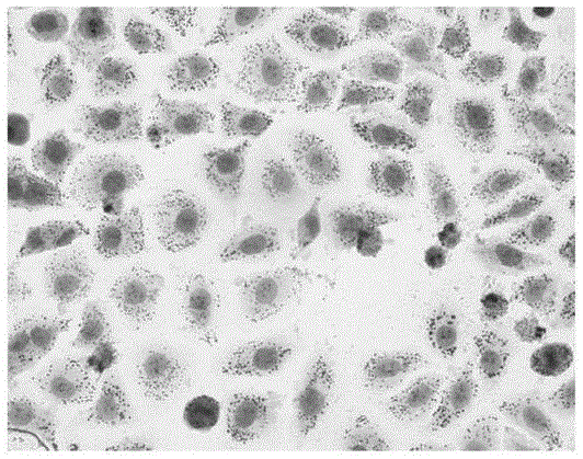 Enzymatically decomposed clam oligopeptide having recovery effect on non-alcoholic fatty liver disease cell model and preparation method of calm oligopeptide