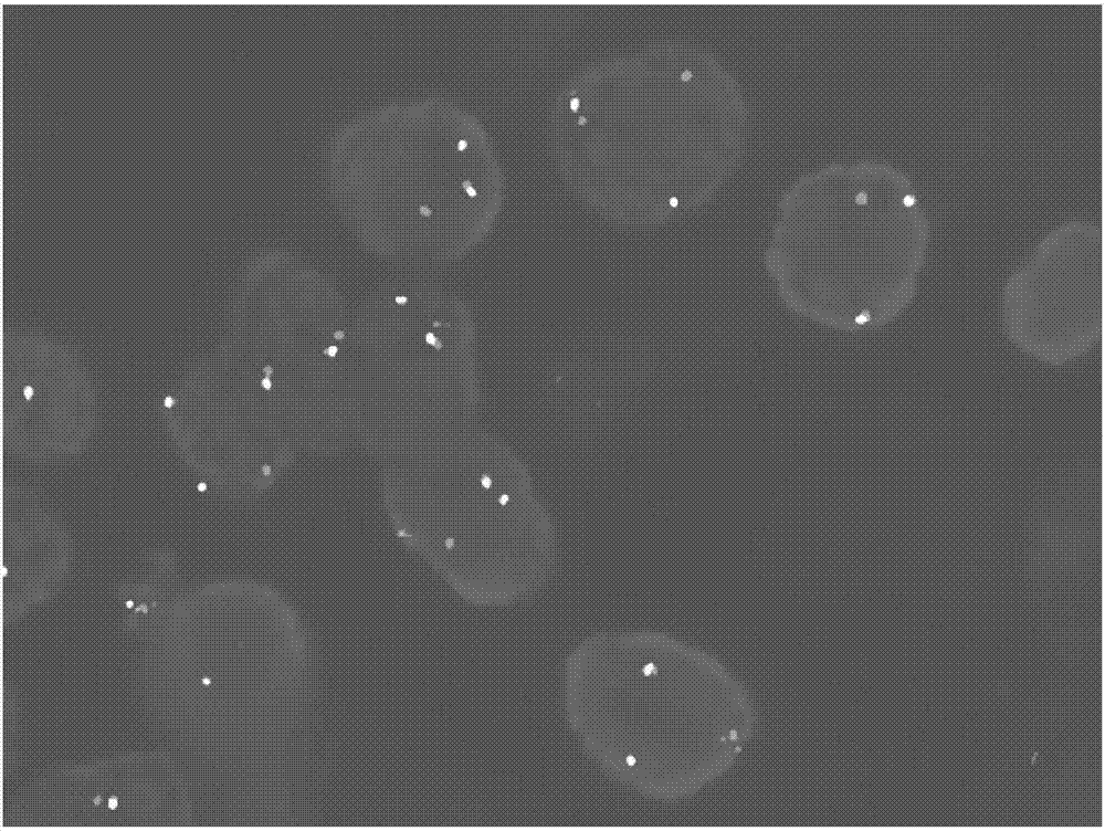 Separating probe combination for diagnosing MITF (Microphthalmia-associated Transcription Factor) translocation kidney cancer and application of separating probe combination