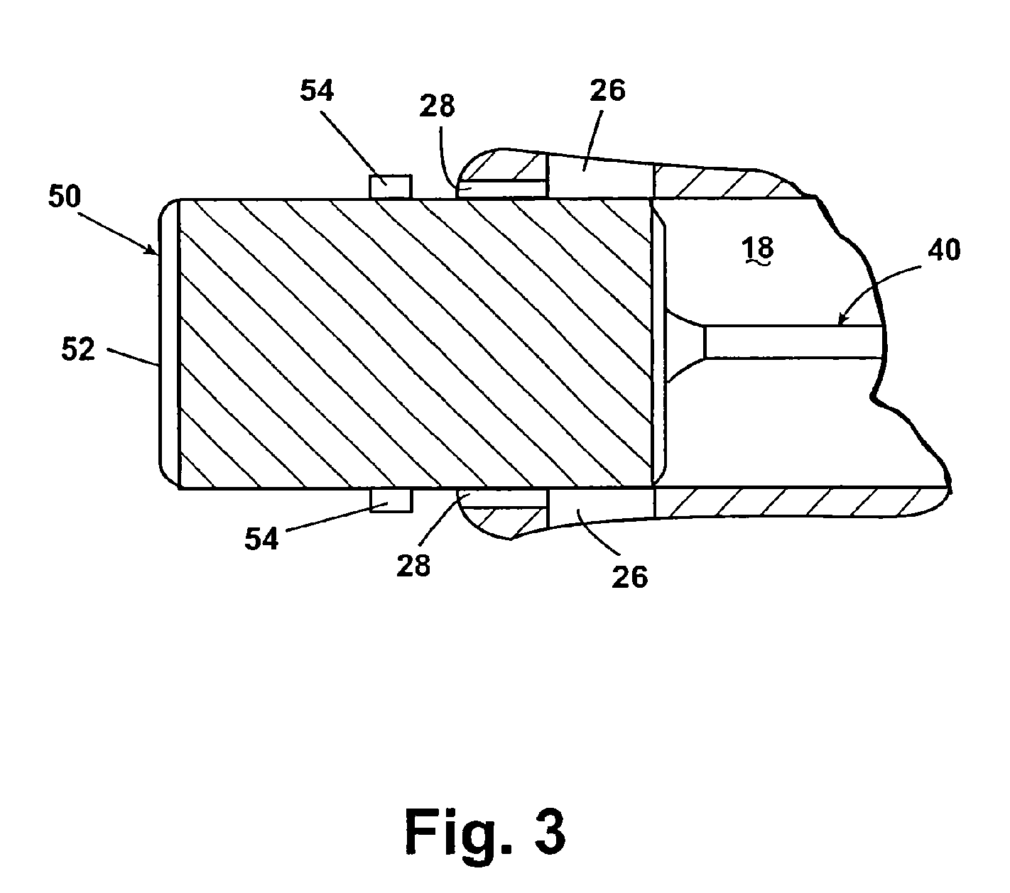 Apparatus for the percutaneous marking of a lesion