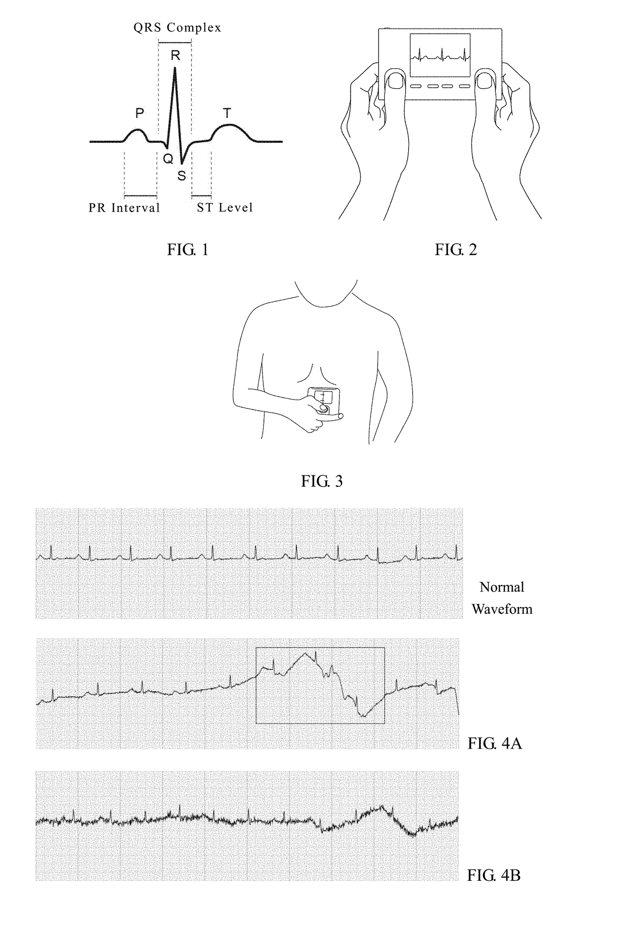 Apparatus for monitoring cardiovascular health