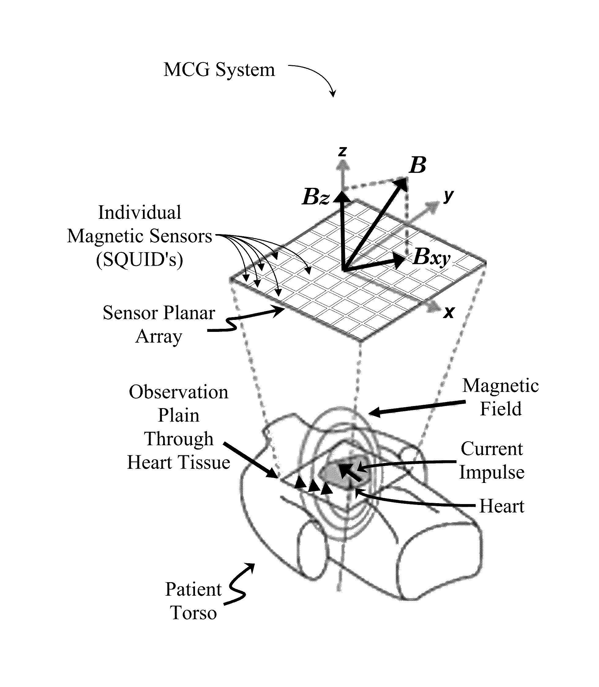 2D dipole localization using absolute value of MCG measurements