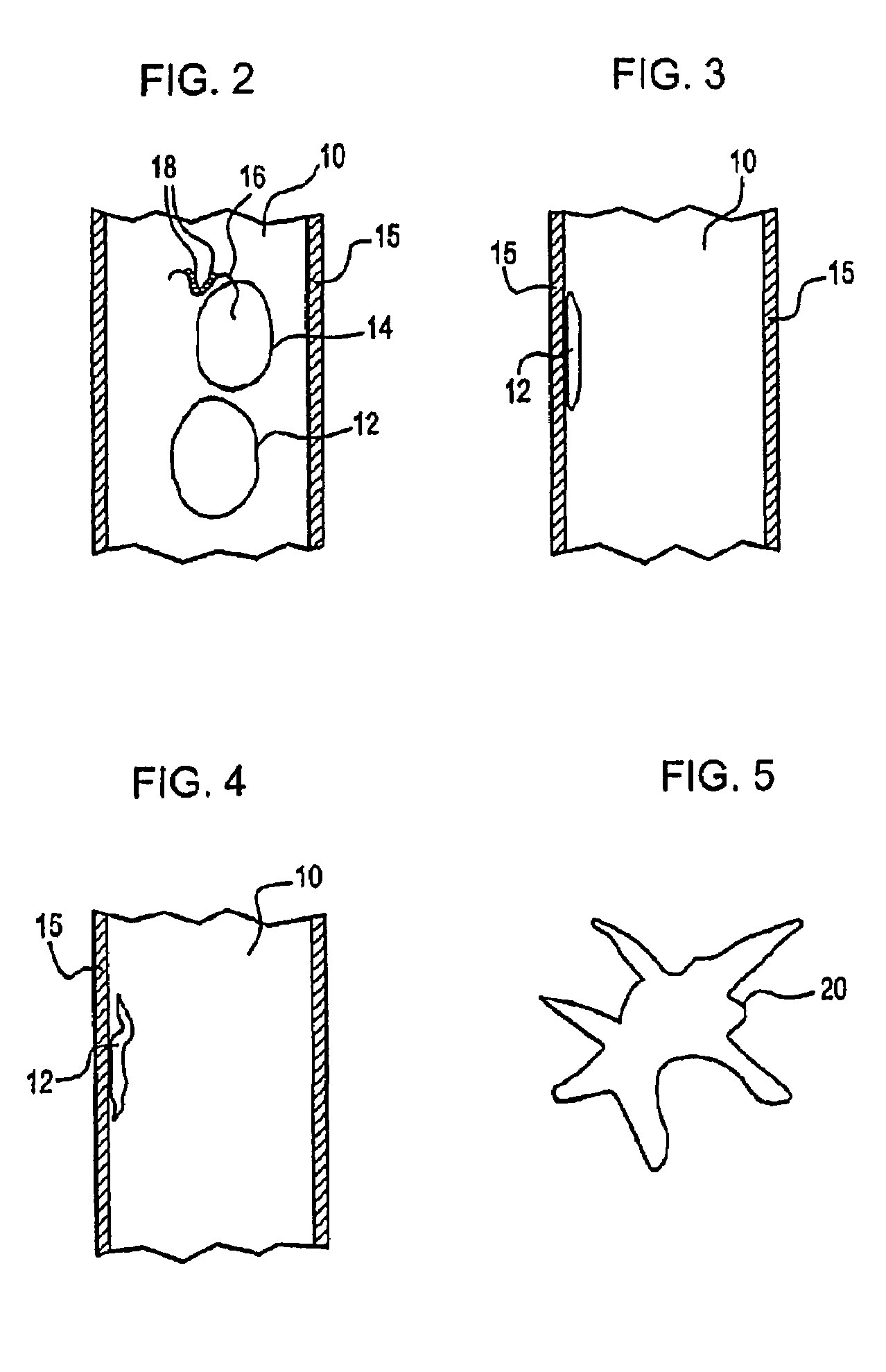 Methods for inducing the differentiation of monocytes into functional dendritic cells and immunotherapeutic compositions including such dendritic cells