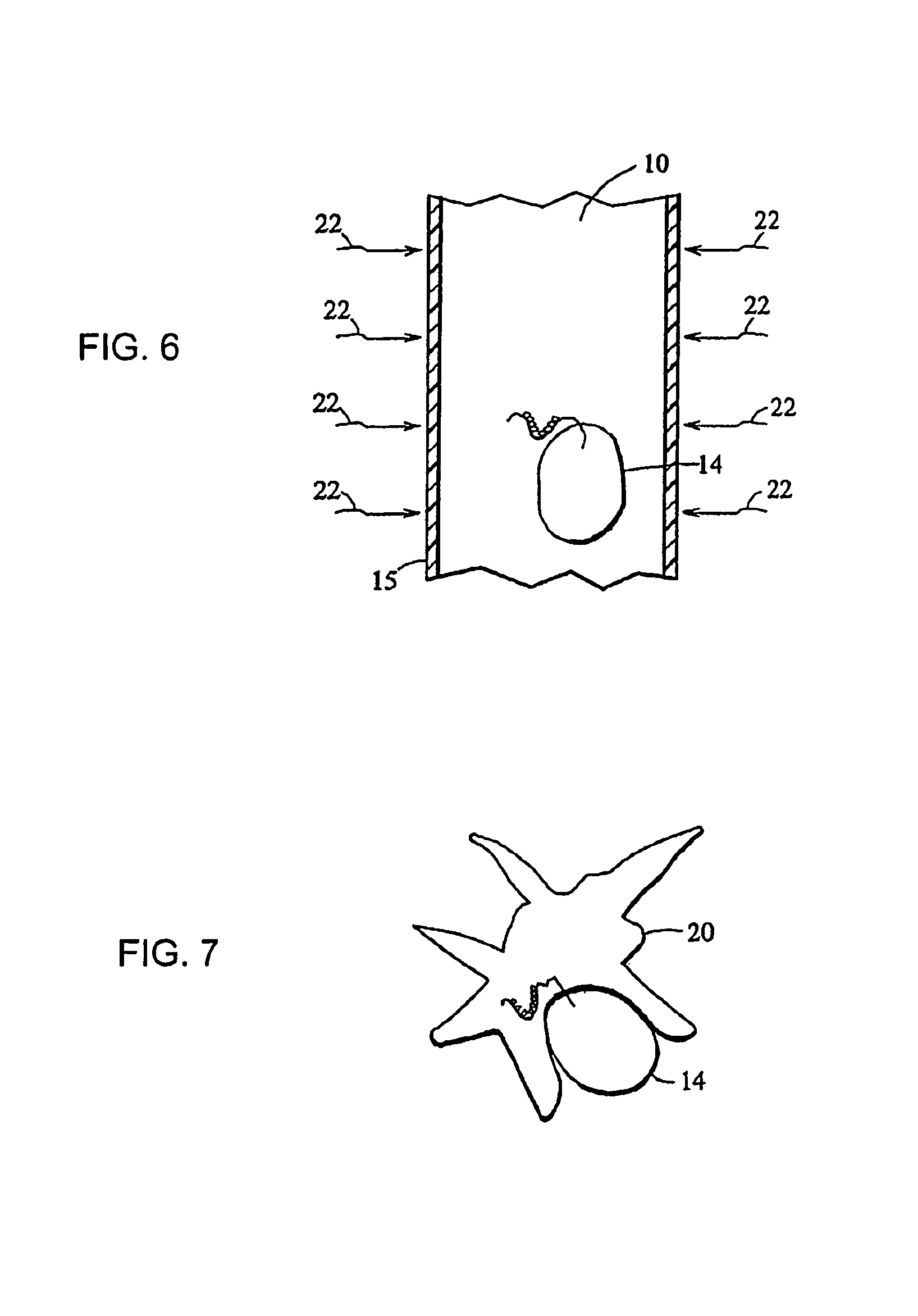 Methods for inducing the differentiation of monocytes into functional dendritic cells and immunotherapeutic compositions including such dendritic cells