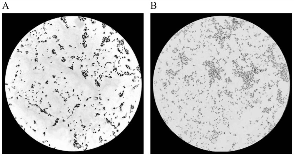 Acid-resistant alkali-resistant rapid-denitrification aerobic denitrifying bacterium, microbial inoculum and application of aerobic denitrifying bacterium and microbial inoculum