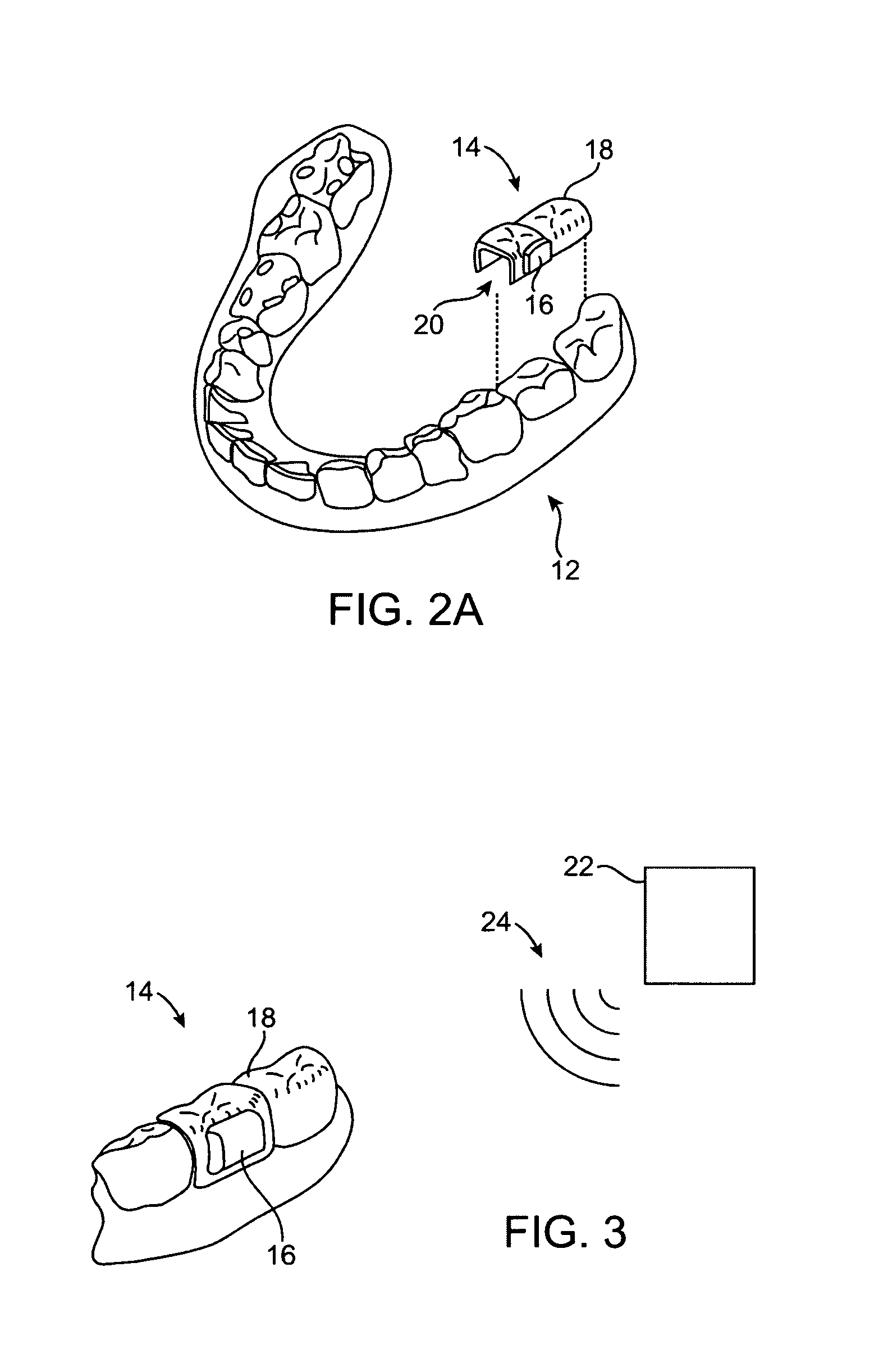 Tinnitus masking systems