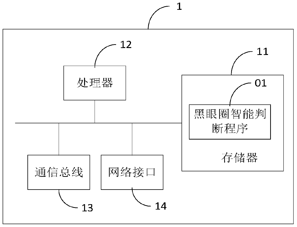 Intelligent judgment method and device for dark eye circles and computer readable storage medium