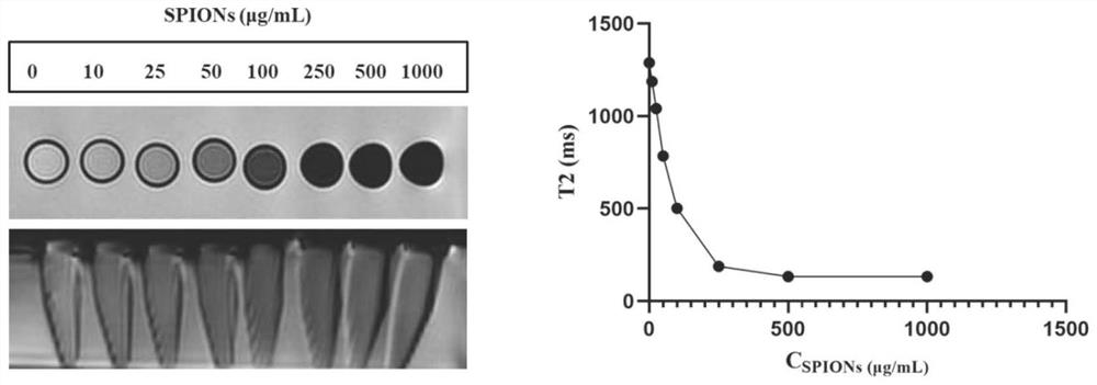 A kind of traditional Chinese medicine compound thermosensitive gel embolic agent and its preparation method and application