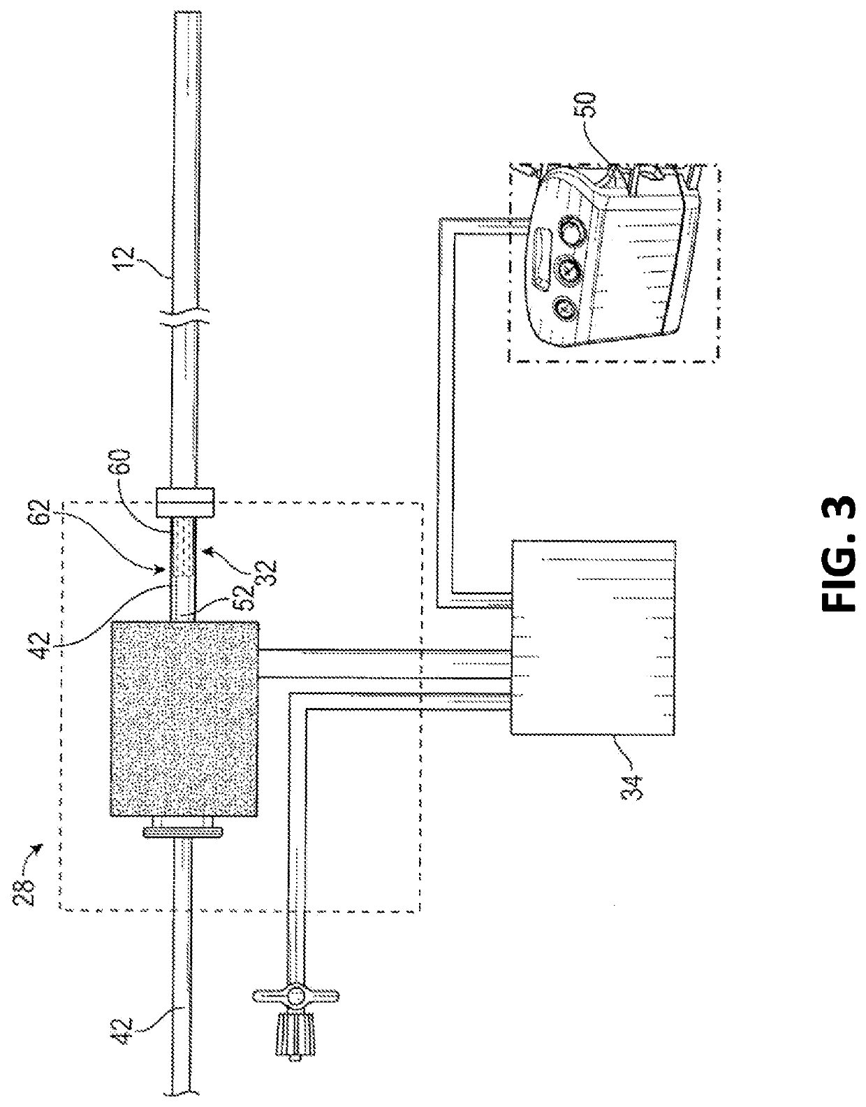 Hemostasis valve