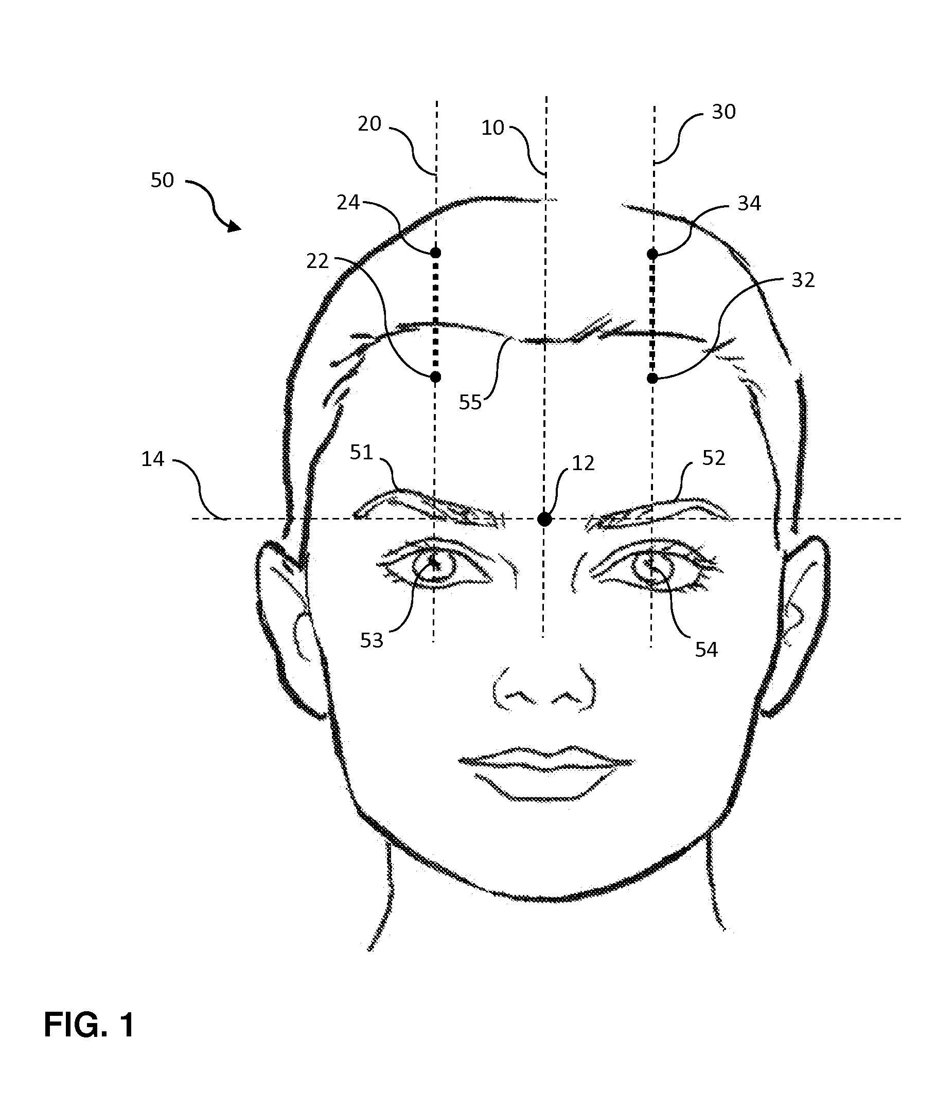 Methods and head-mounted devices for pain relief by stimulating treatment lines along the scalp