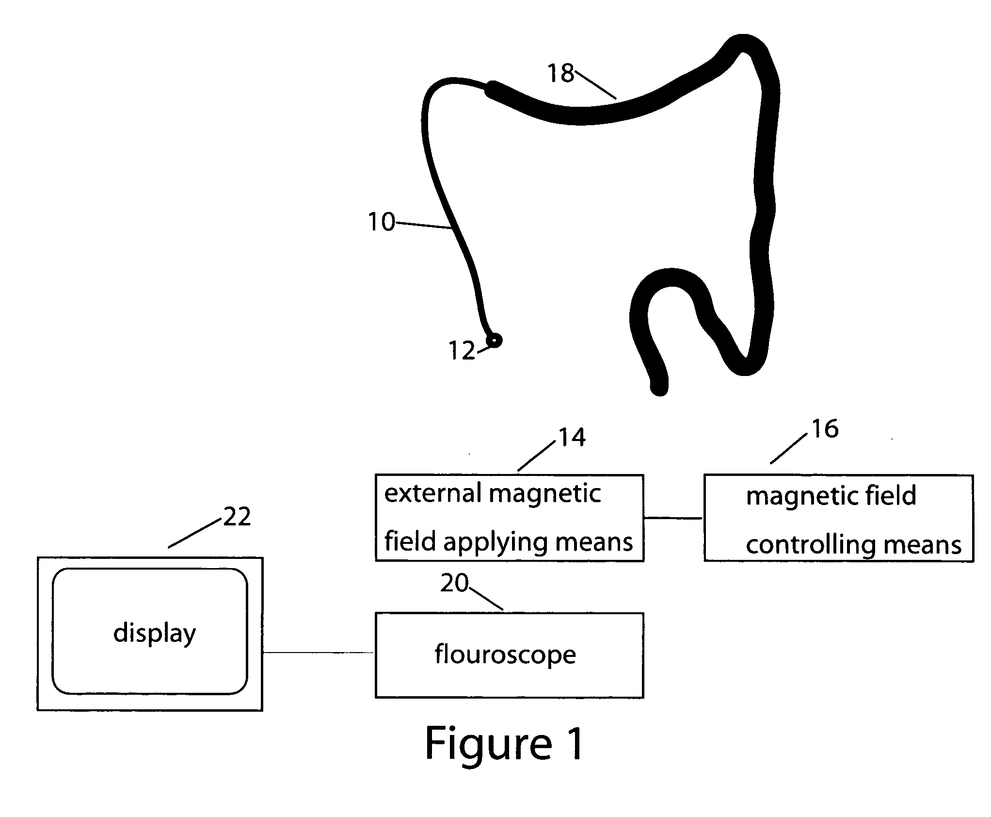 Magnetically guided colonoscope