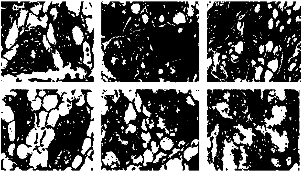 Topical Chinese medicine preparation for treatment of mammary breast gland lobular hyperplasia