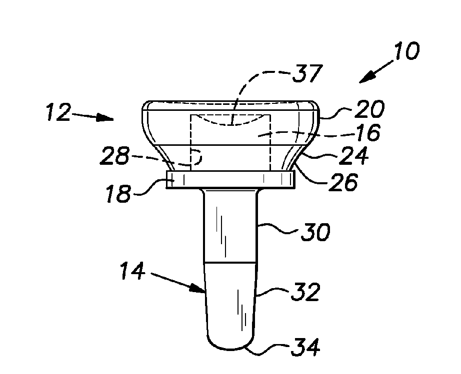 Small joint orthopedic implants and their manufacture