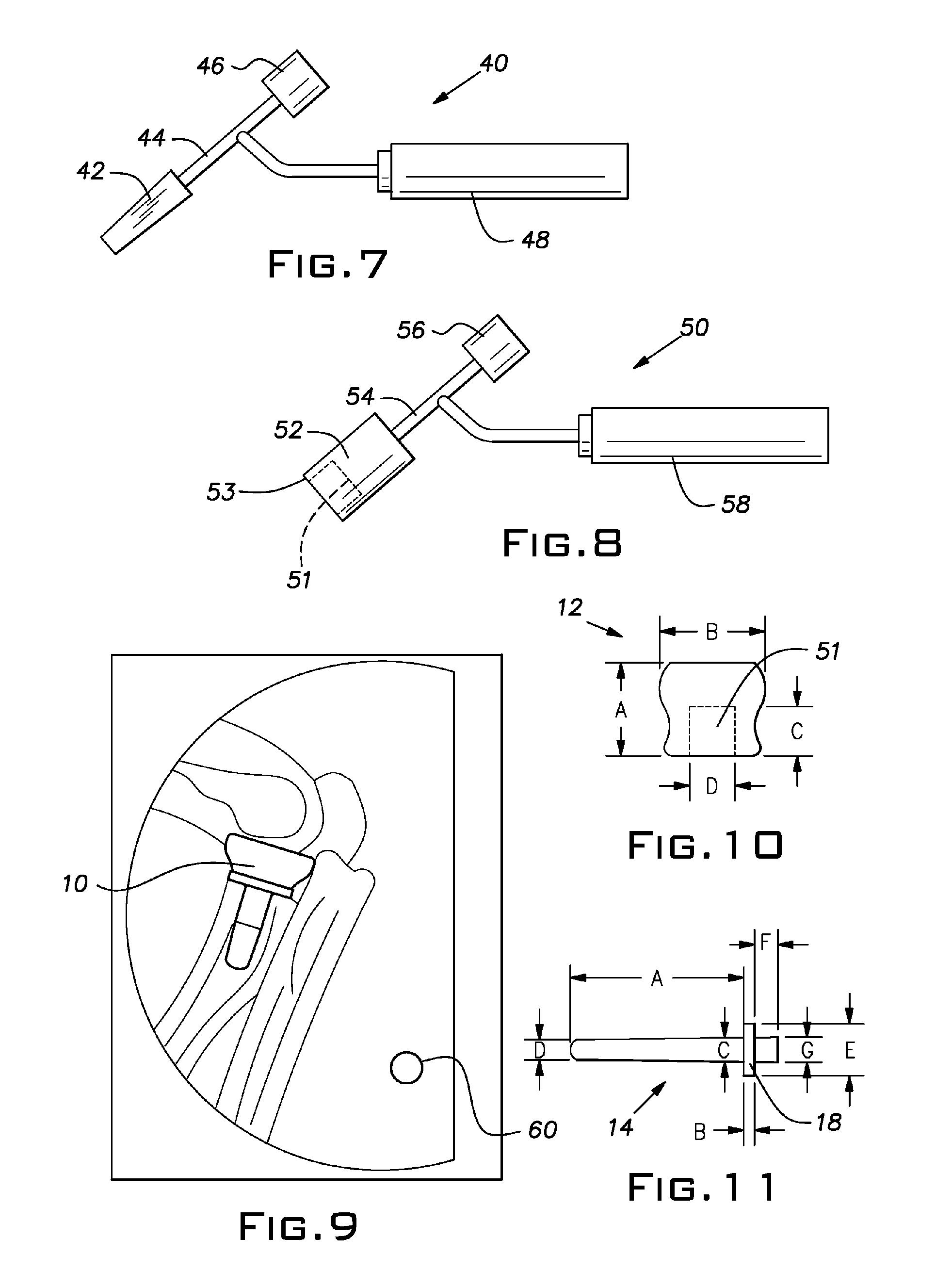 Small joint orthopedic implants and their manufacture