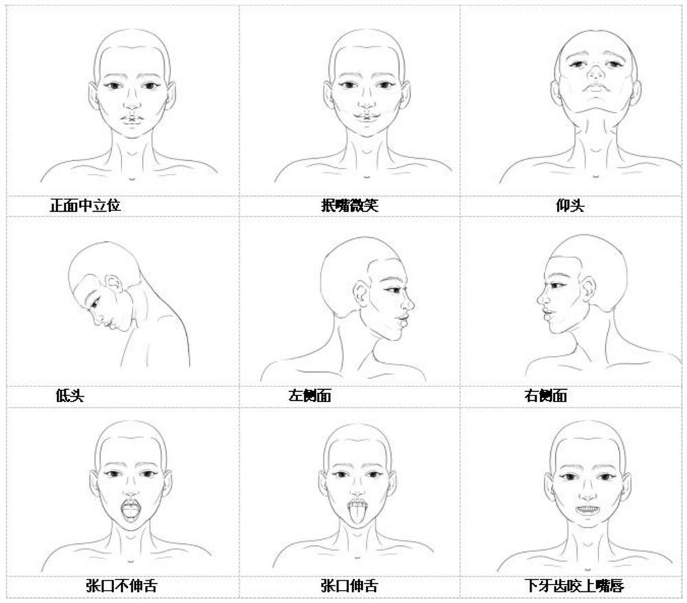 A method and device for evaluating difficult airway based on artificial intelligence