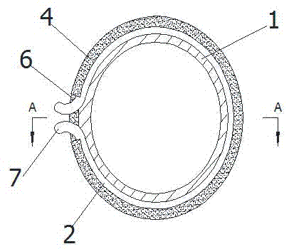 Combined acetabular prosthesis