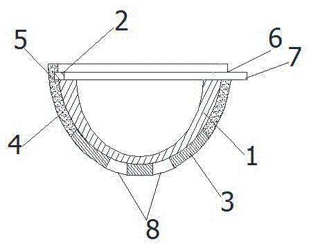 Combined acetabular prosthesis