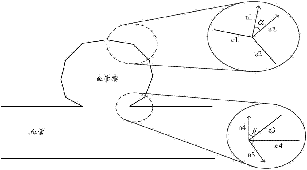 Simulation method and device for interventional embolization operation process