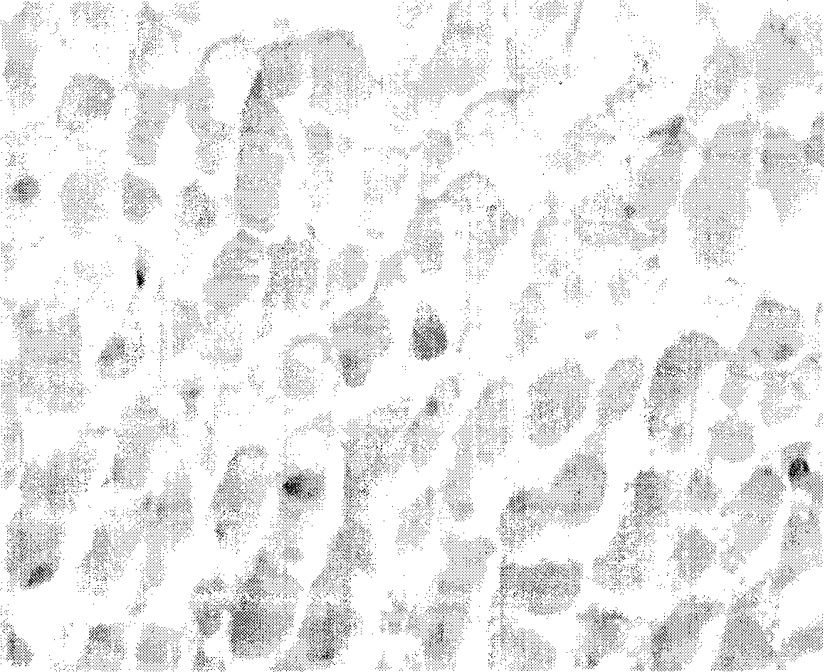 Method for preparing HAP/beta-TCP structured tissue engineering bone