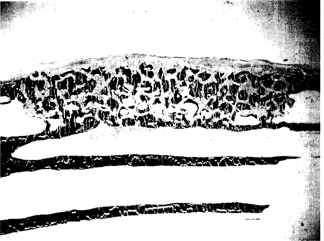 Method for preparing HAP/beta-TCP structured tissue engineering bone