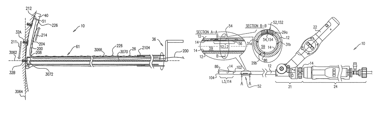 Annuloplasty ring delivery cathethers