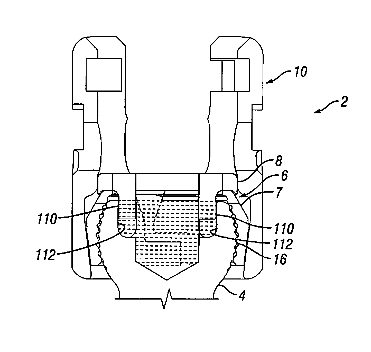 Orthopedic fixation devices and methods of installation thereof